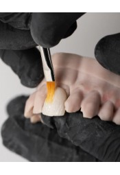 MPF Paste Ceramic Characterization Kit - Master