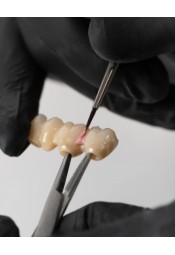 MPF Paste Ceramic Characterization Kit - Master